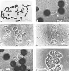 Attēlu rezultāti vaicājumam “Didymium difforme spores”