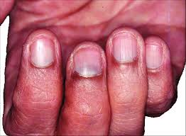 Image result for lunula nail