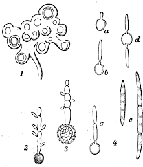 Attēlu rezultāti vaicājumam “Lycogala botrydium spores”