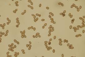 Attēlu rezultāti vaicājumam “Tubifera montana spores”