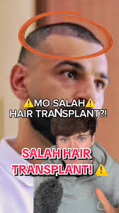 Image result for Liverpool Transplant FC