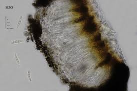 Attēlu rezultāti vaicājumam “Opegrapha rufescens”