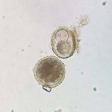 Image result for cestoda excrement dog