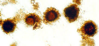 Attēlu rezultāti vaicājumam “Diderma simplex spores”