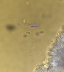 Attēlu rezultāti vaicājumam “Mucronella calva”