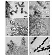Attēlu rezultāti vaicājumam “Badhamia affinis var. microspora spores”