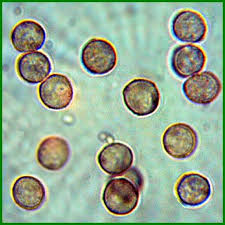 Attēlu rezultāti vaicājumam “Stemonitopsis typhina spores”