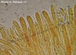 Attēlu rezultāti vaicājumam “Hymenoscyphus calyculus”