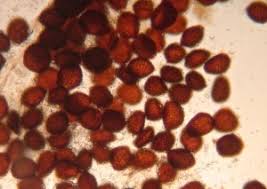 Attēlu rezultāti vaicājumam “Riccia sorocarpa macro”