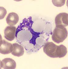 Attēlu rezultāti vaicājumam “Diderma radiatum plasmodium”