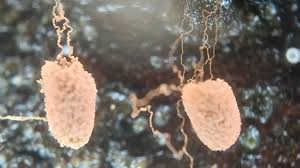 Attēlu rezultāti vaicājumam “Heterotrichia ferruginea (syn. Arcyria ferruginea) spores”