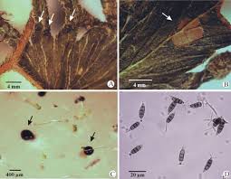 Attēlu rezultāti vaicājumam “Lignydium muscorum spores”