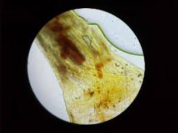 Attēlu rezultāti vaicājumam “Craterium aureonucleatum”