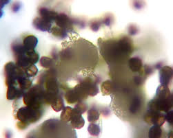 Attēlu rezultāti vaicājumam “Physarum notabile spores”