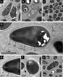Attēlu rezultāti vaicājumam “Badhamia affinis var. microspora macro”