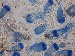 Attēlu rezultāti vaicājumam “Parmeliopsis ambigua”