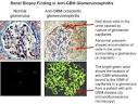 Picture of <b>glomerulus</b> with