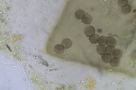 Attēlu rezultāti vaicājumam “Licea minima”