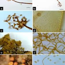 Attēlu rezultāti vaicājumam “Cribraria piriformis young”