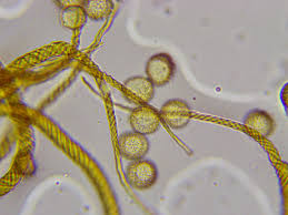 Attēlu rezultāti vaicājumam “Trichia ambigua spores”