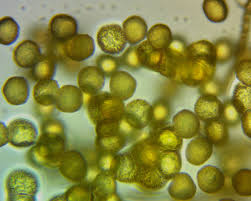 Attēlu rezultāti vaicājumam “Trichia contorta”