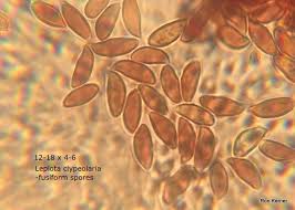 Attēlu rezultāti vaicājumam “Lepiota clypeolaria”