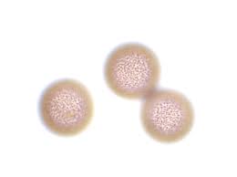 Attēlu rezultāti vaicājumam “Lycogala cf. fossiculatum sessile”