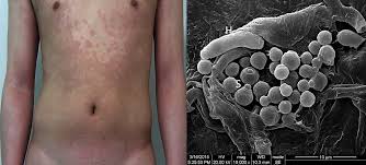 Attēlu rezultāti vaicājumam “Badhamia versicolor spores”