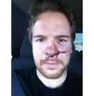 Here's Ryan Duncan, former Hobey Baker Award winner, after taking ...