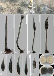 Attēlu rezultāti vaicājumam “Rosellinia desmazieri spores”