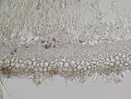 Attēlu rezultāti vaicājumam “Lachnum corticale”