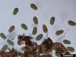 Attēlu rezultāti vaicājumam “Stemonitopsis aequalis var. microspora stalked”