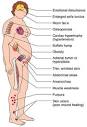 Images related to Cushing's disease