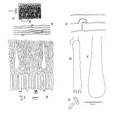 Attēlu rezultāti vaicājumam “Phlebia radiata”