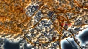 Attēlu rezultāti vaicājumam “Trichia botrytis var. cerifera stalked”