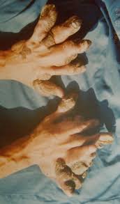 Image result for Lewandowsky-Lutz