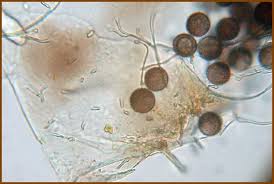 Attēlu rezultāti vaicājumam “Lamproderma gulielmae spores”