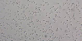 Attēlu rezultāti vaicājumam “Tyromyces chioneus”