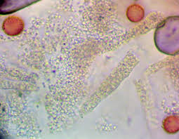 Attēlu rezultāti vaicājumam “Badhamiopsis macrospora”
