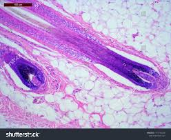 Image result for human hair microscope image