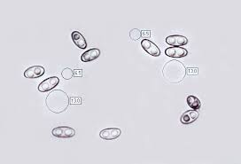 Attēlu rezultāti vaicājumam “Otidea onotica”