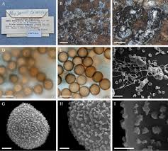 Attēlu rezultāti vaicājumam “Trichia crateriformis stalked”