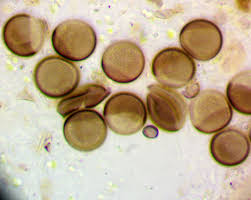 Attēlu rezultāti vaicājumam “Licea testudinacea spores”