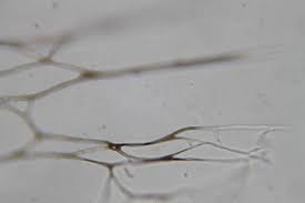 Attēlu rezultāti vaicājumam “Diderma subviridifuscum spores”