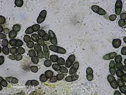 Attēlu rezultāti vaicājumam “Calicium viride”