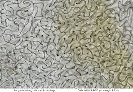 Attēlu rezultāti vaicājumam “Nostoc commune cells”