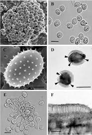 Attēlu rezultāti vaicājumam “Melampsora epitea”