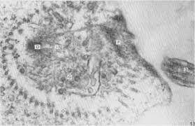 Attēlu rezultāti vaicājumam “Physarum flavicomum stalked”