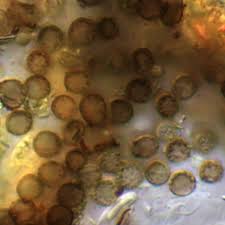 Attēlu rezultāti vaicājumam “Xanthoriicola physciae”