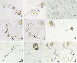 Attēlu rezultāti vaicājumam “Coleosporium sp.”